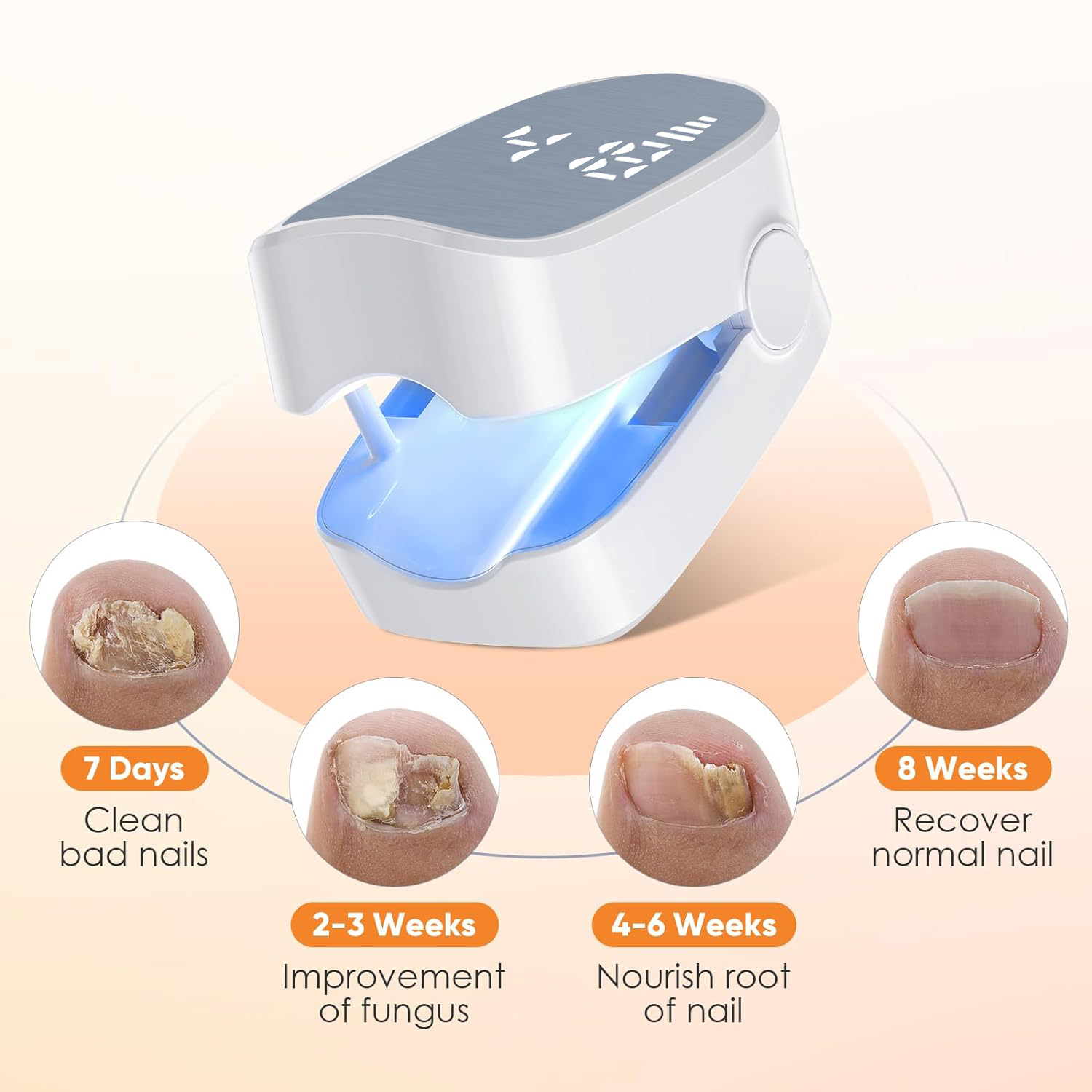1pcs 효과적인 충전식 네일 곰팡이 제거제 네일 곰팡 - Industrial Laser Removal 리뷰 및 가격