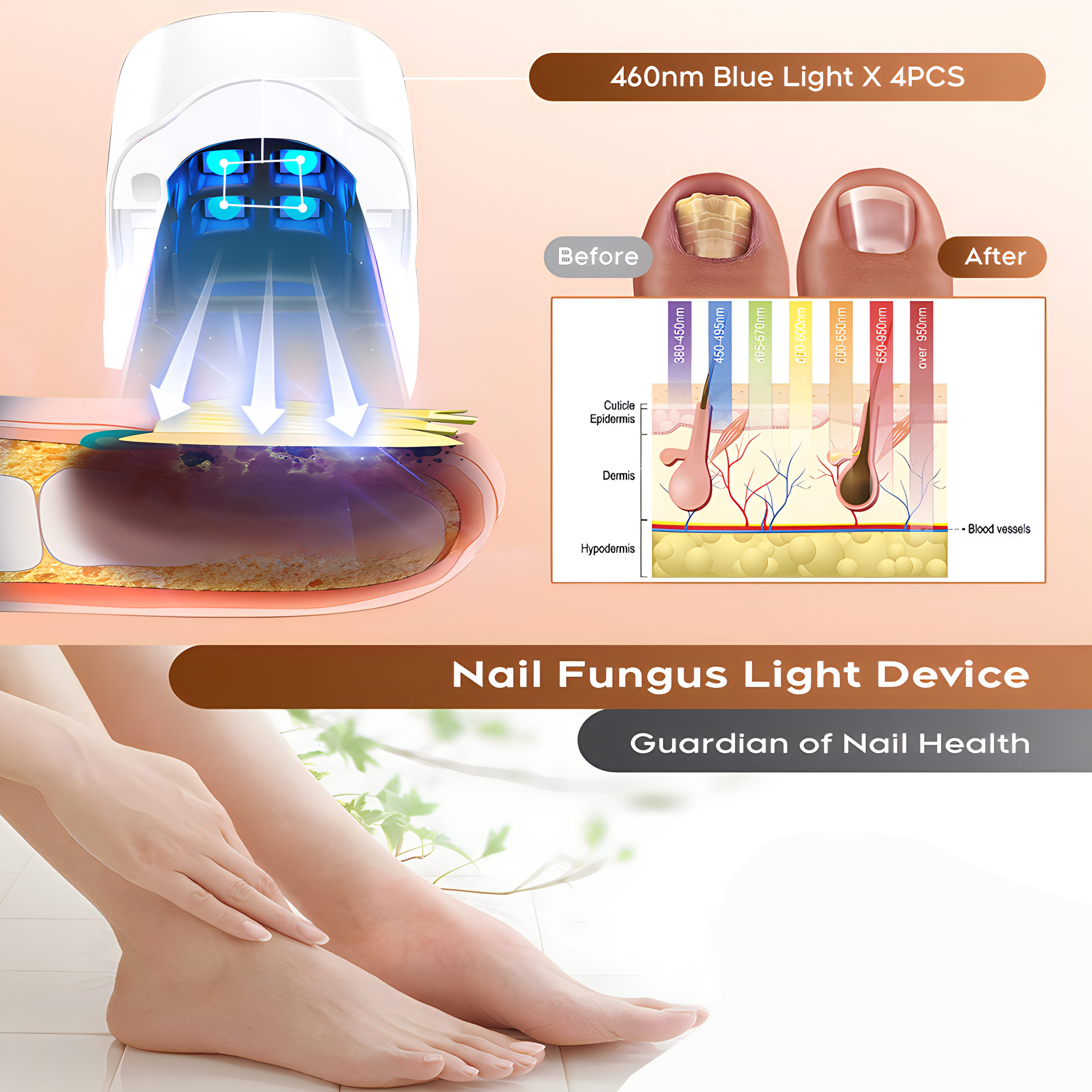 1pcs 효과적인 충전식 네일 곰팡이 제거제 네일 곰팡 - Industrial Laser Removal 리뷰 및 가격